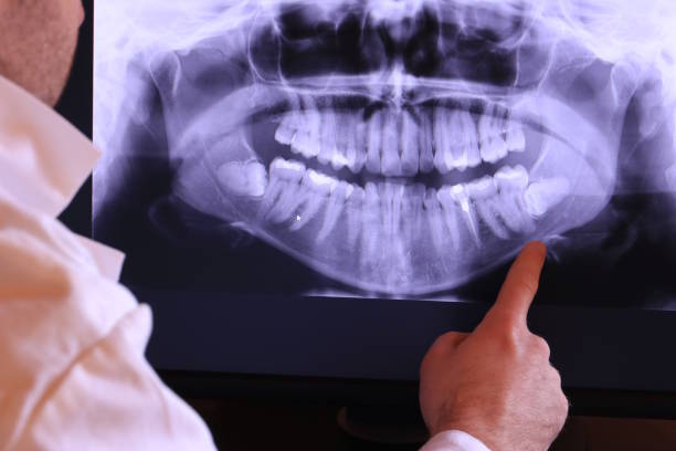 Best Cracked Tooth Emergency Dentist  in West Unity, OH