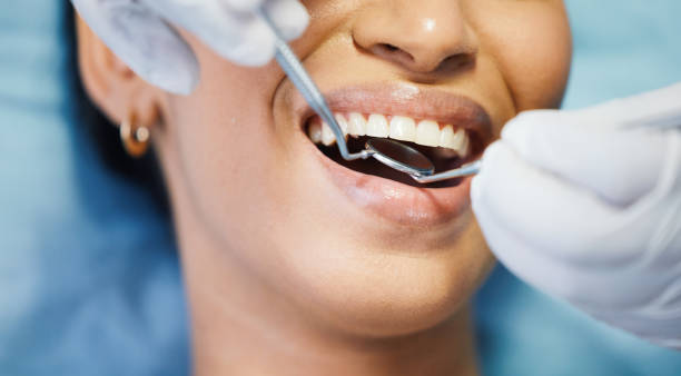 Best Dentist for Tooth Abscess  in West Unity, OH